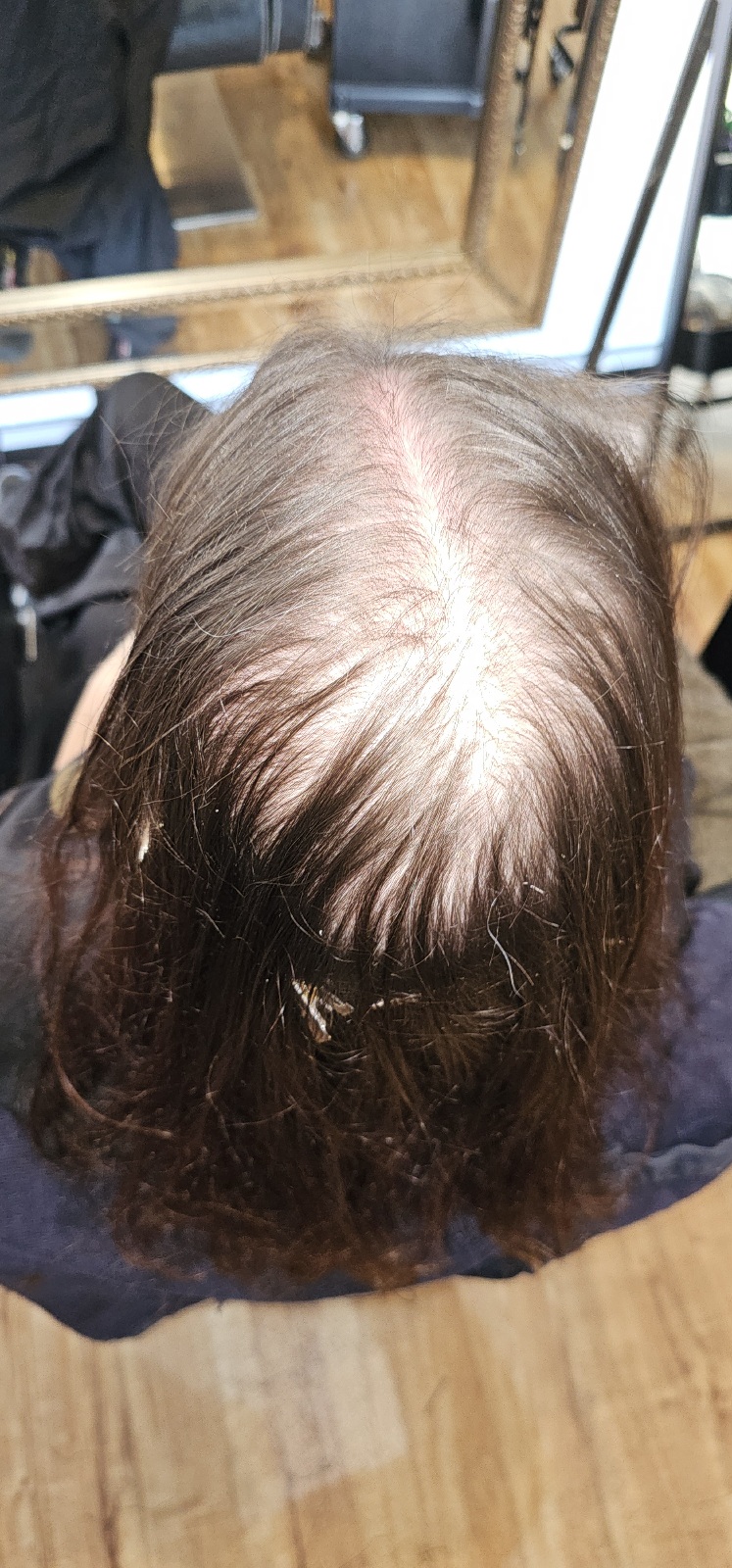 https://perthmeshhairintegration.com.au/wp-content/uploads/2024/09/20240821_123932.jpg
